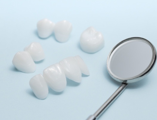Metal free dental restorations prior to placement